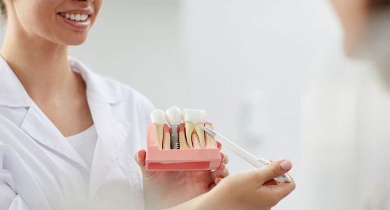 Periodontics in Wichita