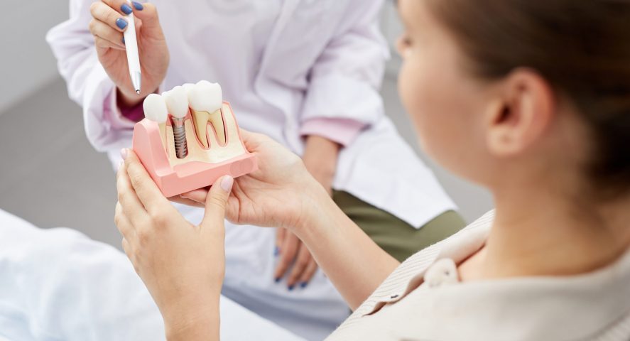 Dental Implants in Wichita