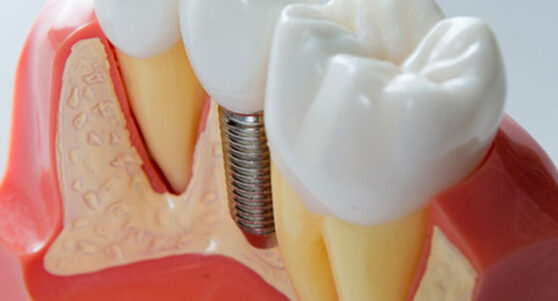 AdobeStock 303900668 (8) (1)