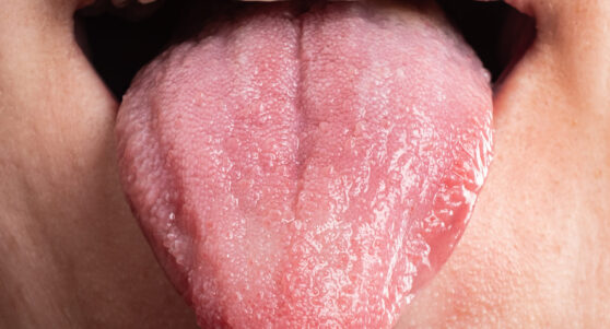 general dentist oral cancer