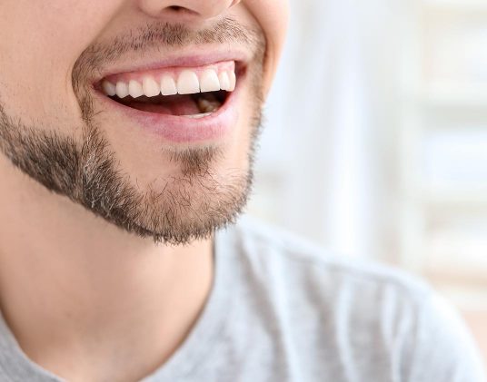 Professional Teeth Whitening Wichita Smile Makeovers